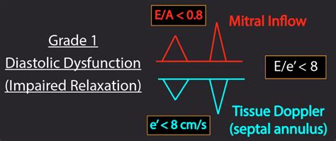 diastolic dysfunction grade 1 prognosis.